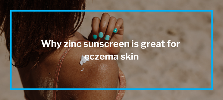 Why zinc sunscreen is great for eczema skin