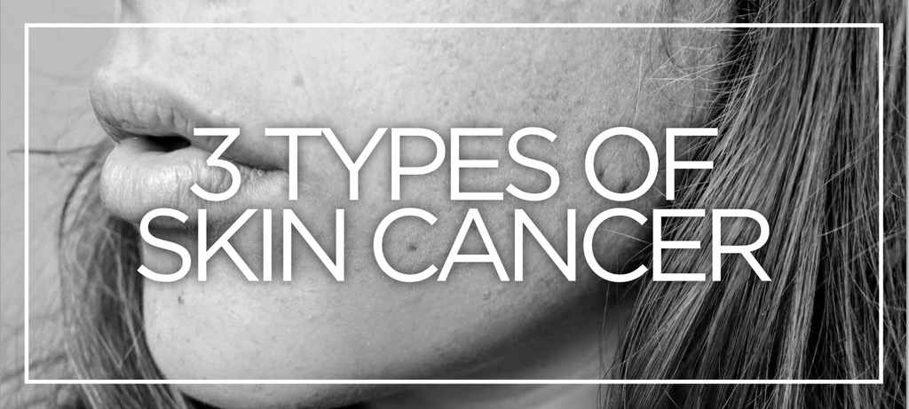 The 3 types of skin cancer you need to know